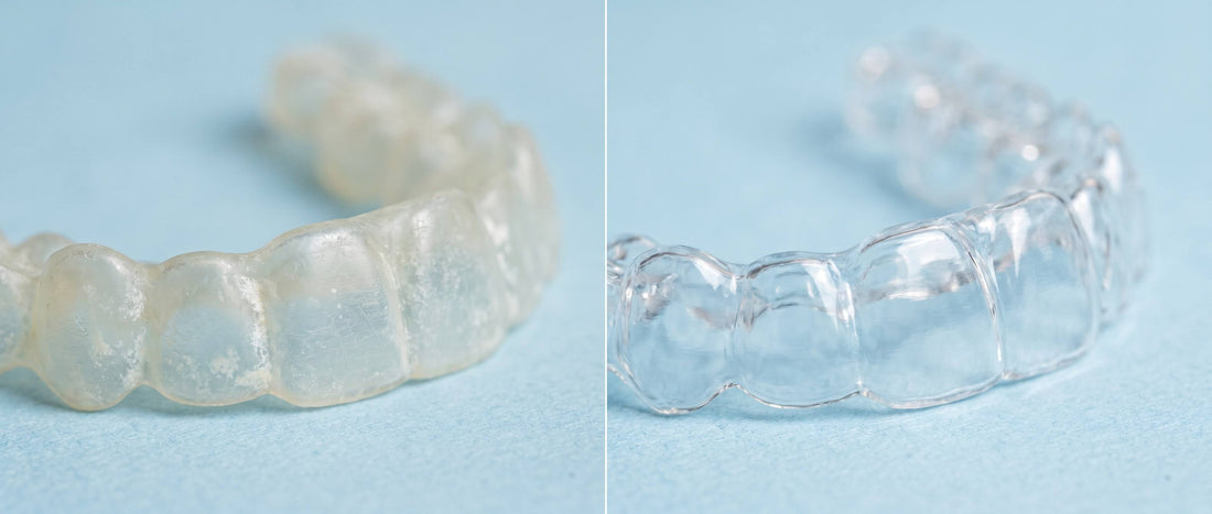 Why Are My Retainers Cloudy After Cleaning?